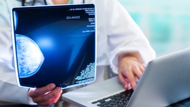 Inteligência artificial e o câncer de mama