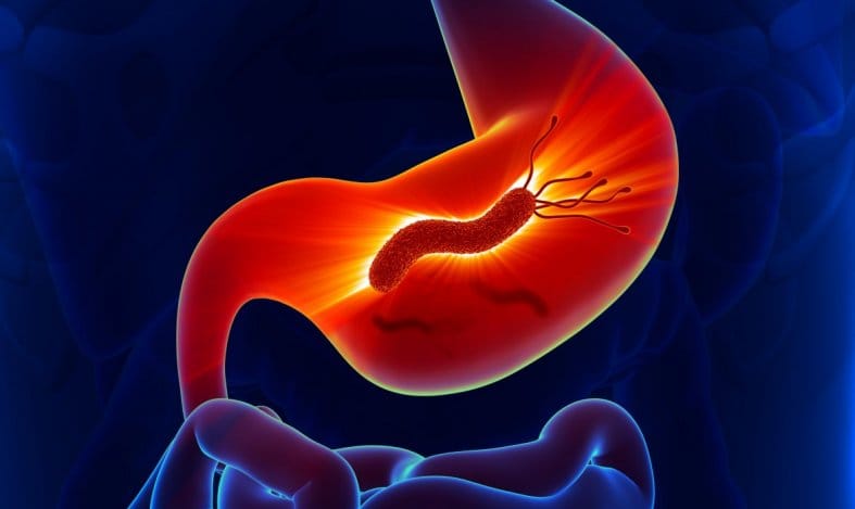 O papel do Helicobacter pylori no câncer de estômago