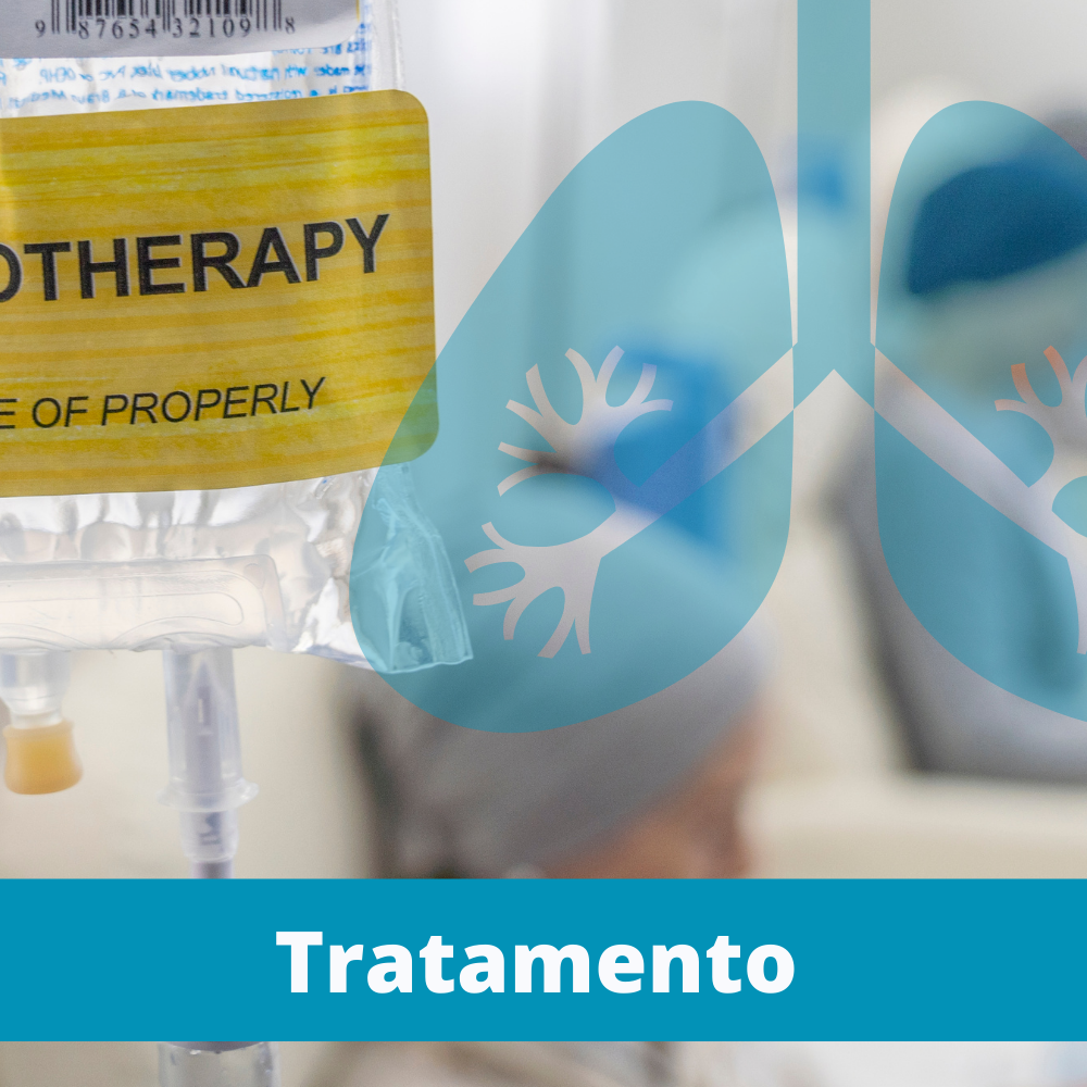 Tratamento do Câncer de Pulmão: Uma Luz na Campanha Agosto Branco