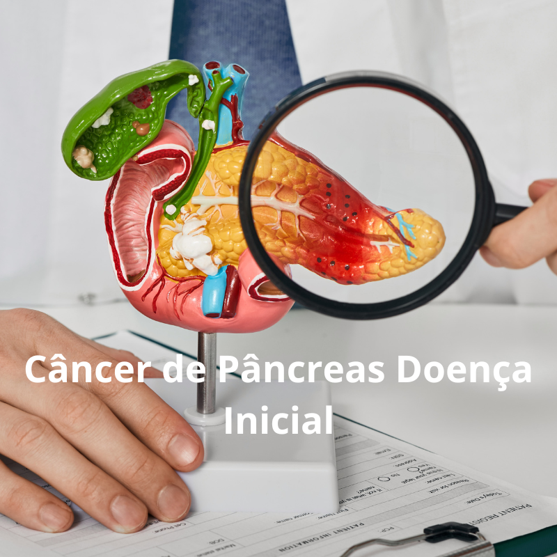 Câncer de Pâncreas: Tratamento da Doença Localizada