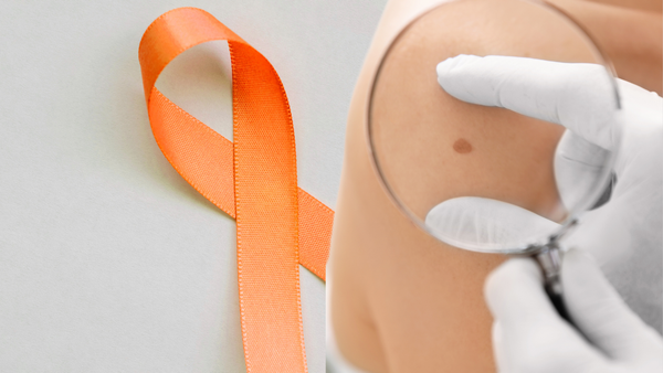 Câncer de Pele no Dezembro Laranja: Conhecimento e Prevenção