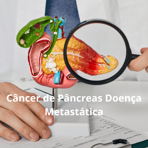 Câncer de Pâncreas: Tratamento da Doença Metastática